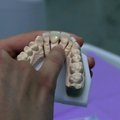 Kaip atliekamas estetinis dantų protezavimas laminatėmis?