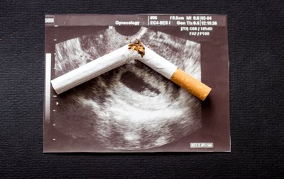 Nėštumas ir rūkymas