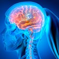 Nauji smegenų implantai gali „skaityti“ žodžius tiesiai iš žmonių minčių