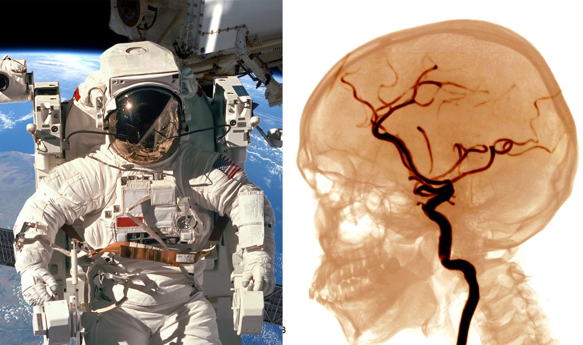 Kosmose pažeidžiamos astronautų smegenys.