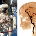 Iš kosmoso grįžusių astronautų kraujyje – grėsmingi radiniai: įspėjo apie negrįžtamus pokyčius smegenyse