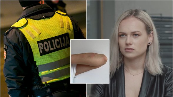 Užpulta serialo „Rimti reikalai“ aktorė Dovilė Kundrotaitė: vyras spyrė į galvą, kreiptasi į policiją