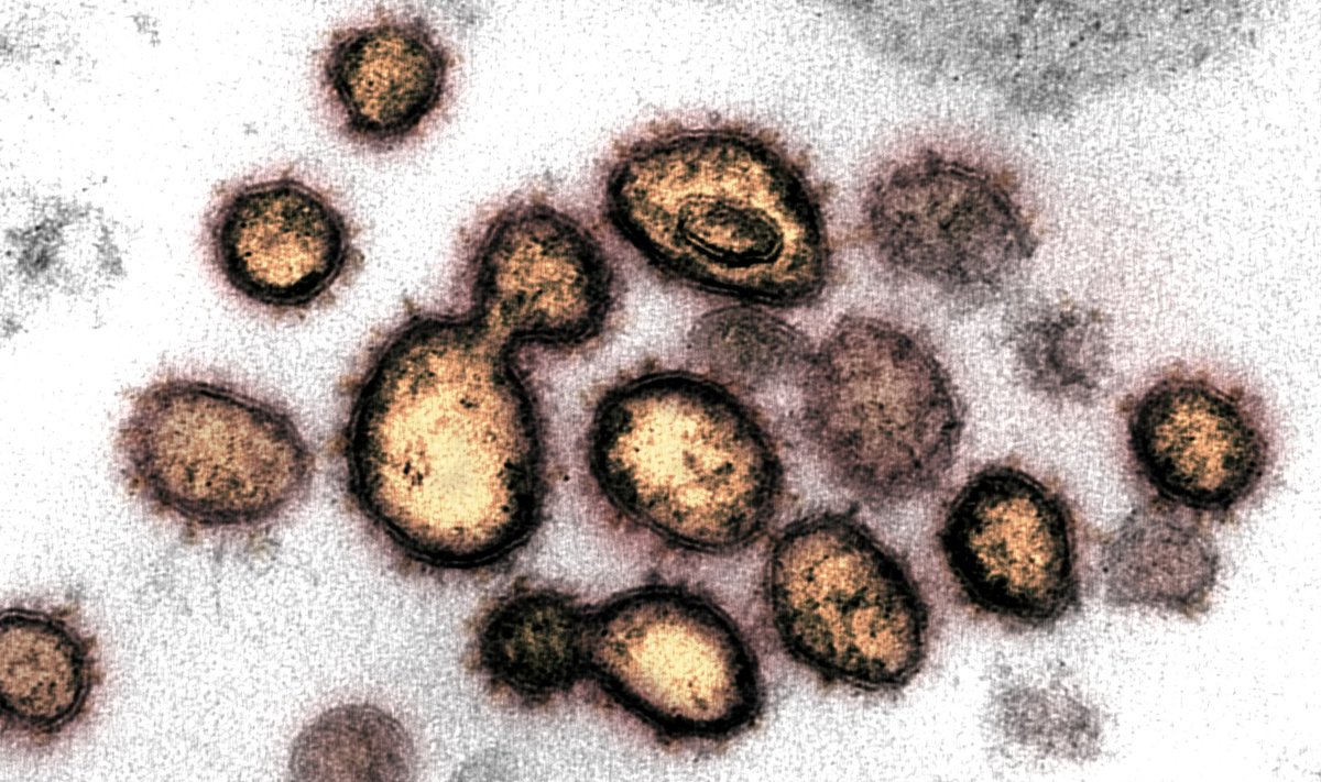 Kaip atrodo naujasis koronavirusas per mikroskopą