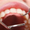 Iškritus plombai – netikėtas odontologo verdiktas: danties išsaugoti nebegalima