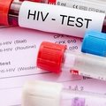 Daugėja susirgimų ŽIV