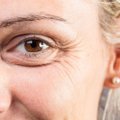 Glaukoma – akių liga, kurios padariniai negrįžtami: gydytoja patarė, kaip jai laiku užkirsti kelią
