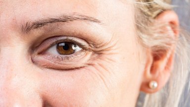 Glaukoma – akių liga, kurios padariniai negrįžtami: gydytoja patarė, kaip jai laiku užkirsti kelią
