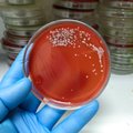 Japonijoje plinta liga, kurią sukelia „mėsą ėdanti bakterija“ – ji gali nužudyti per dvi dienas