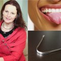 Pažiūrėkite į savo liežuvį – daug kas paaiškės apie jūsų sveikatą: būtinai priežiūrai dantų šepetėlio neužteks