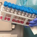Nacionalinė laboratorija: pasiekta tyrimų dėl koronaviruso pajėgumų riba