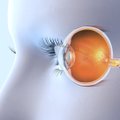 Gydytoja oftalmologė – apie tai, dėl ko ankstyvesnė kataraktos išsivystymo rizika padidėja iki 3 kartų