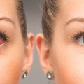 Sausos akys žiemą – kaip sau padėti ir išvengti rimtesnių komplikacijų
