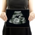 Seimo darbų plane – sprendimas dėl abortų: nėštumo nutraukimas būtų draudžiamas