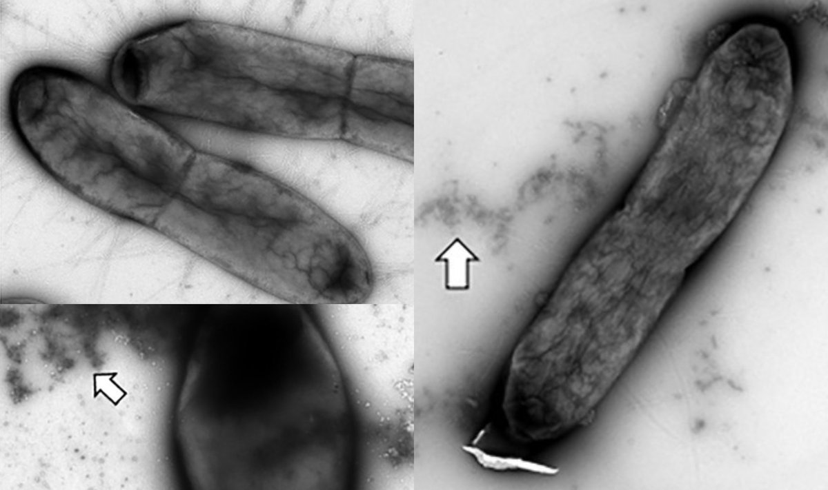 Sidabro nanodalelės įveikia antibiotikams atsparias bakterijas. Daniel Czyż/Autumn Dove iliustr.
