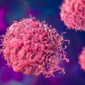 Kviečia išsitirti dėl 4 rūšių vėžio: daliai žmonių tyrimai atliekami nemokamai