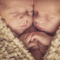 Arizonoje skirtingais metais gimę dvyniai nustebino ir tėvus, ir gydytojus