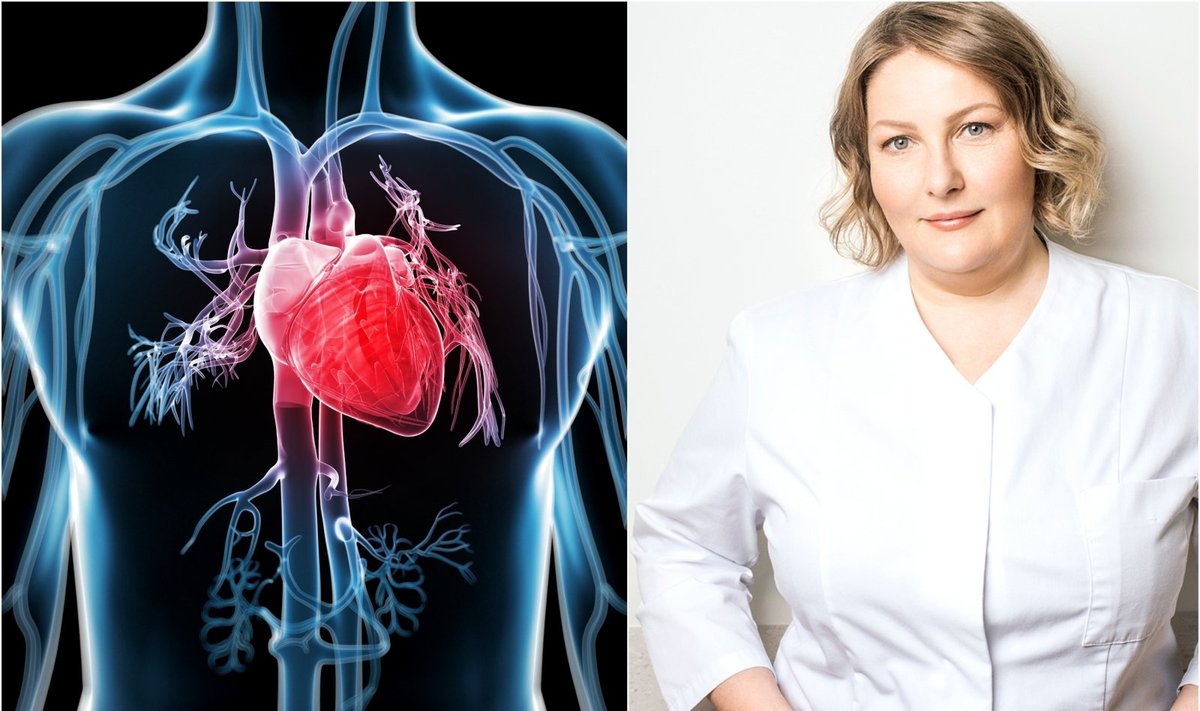 Santaros klinikos gydytoja kardiologė Milda Kovaitė papasakojo apie širdies ligas