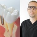 Odontologas – apie tai, kas padeda užtikrinti implantacijos sėkmę, net ir sudėtingais atvejais