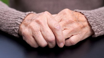 Medikė paneigė mitą, kad Parkinsonu susergama po 50: ligą užčiuopti galima pastebėjus 3 simptomus