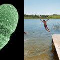Specialistai įspėja į šį vandens telkinį Lietuvoje nekelti nė kojos: užsiveisė pavojingi parazitai