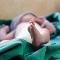 Dauguma gimusių kūdikių verkia, bet ne šis: naujagimio išraiška be žado paliko net medikus