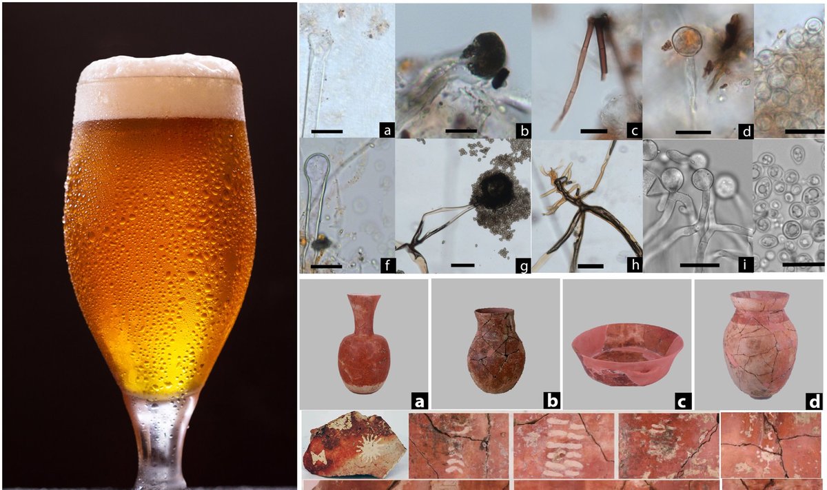 Kinijoje aptikti alaus gamybos įrodymai ir mikroskopiniai senovinio alaus likučiai. Jiajing Wang/Leping Jiang/Hanlong Sun iliustr.