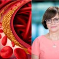 Kardiologė perduoda svarbią žinią apie cholesterolio tyrimą: kam ir kada privalu nedelsiant atlikti?