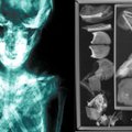 Mumifikuotus nėščios moters palaikus tyrinėję archeologai netikėtai aptiko dar šiurpesnių radinių: apie tai niekas nežinojo