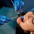 Kelerius metus pašlijusios sveikatos priežasčių ieškojusi moteris tokios diagnozės nesitikėjo: ko nerado terapeutai, surado odontologas