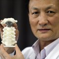 Vaikui implantavo 3D spausdintuvu sukurtą stuburo slankstelį