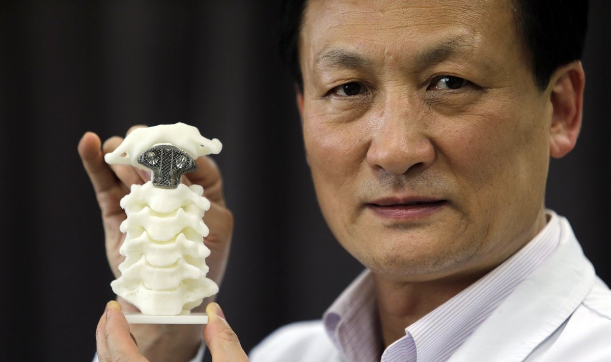 Medikas Liu Zhongjunas demonstruoja stuburo su 3D spausdintuvu atspausdintu slanksteliu modelį
