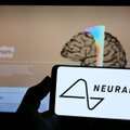 Musko įmonei „Neuralink“ leista eksperimentuoti su žmonių smegenimis: netrukus ieškos savanorių