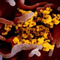 Ekspertas paaiškina: kaip kovodami su koronavirusu turite tinkamai vėdinti patalpas