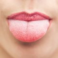 Liežuvio spalva išduoda, ko trūksta organizmui