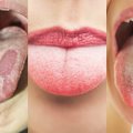 Šeimos gydytojas: kaip turi atrodyti sveiko žmogaus liežuvis ir kaip juo taisyklingai rūpintis