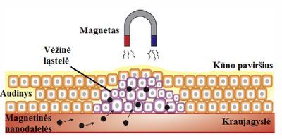 4 pav. Antivėžinio vaisto pernešimas į naviką naudojant magnetines nanodaleles. Prie magnetinės nanodalelės prijungiamas antivėžinis vaistas. Naudojant magnetinį lauką nanodalelės nukreipiamos į vėžinį audinį ("Spectrum" iliustr.)