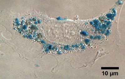 1 pav. Magnetinių dalelių susikaupimas ląstelėje po 24 val. inkubacijos. Geležies oksido nanodalelės reaguoja su Berlyno mėlio reagentu, todėl tikslų jų pasiskirstymą ląstelėje galima identifikuoti fazinio kontrasto mikroskopu pagal vaizdinimo žymeklio mėlynos s