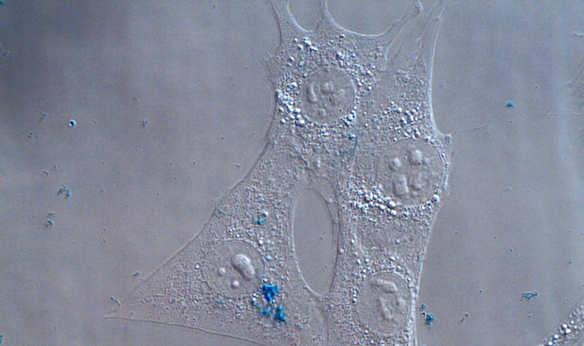 Magnetinės nanodalelės, susikaupusios pelės embriono fibroblastuose. Nuotrauka padaryta Biomedicininės fizikos laboratorijoje (NVI), naudojant šviesaus lauko mikroskopą ir spalvotą skaitmeninę kamerą (G. Jarockytės nuotr.)