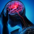 Galvos skausmo vieta parodys jo priežastį: vaistininkas įspėjo, kada tai gali būti insulto požymis