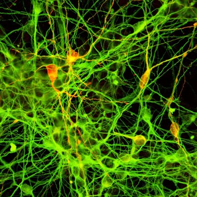 Dopaminerginiai neuronai
