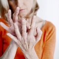 Pasaulinė artrito diena: trečdalis žmonių jaučia raumenų ir kaulų ligų požymius