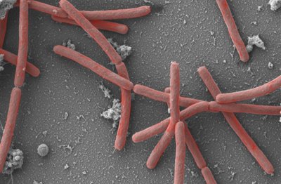 Vandeniliu ir anglies dioksidu mintančios bakterijos. Methanothermobacter thermautotrophicus. Andreas Klingl /https://vaam.de/en/website-microbiology/microbe-of-the-year/contact-press/press-images/ nuotr.