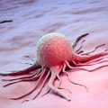 Europos mokslininkai pasakė, kas labiausiai trukdo įveikti vėžį: svarbu išspręsti didžiausią problemą