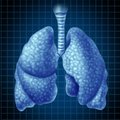 Ankstyvieji plaučių vėžio simptomai: manė, kad šienligė