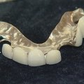 W. Churchillio dantų protezai aukcione parduoti už 23 tūkst. dolerių