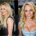 Pamela Anderson – kodėl seksualumo ikona taip anksti paseno? FOTO