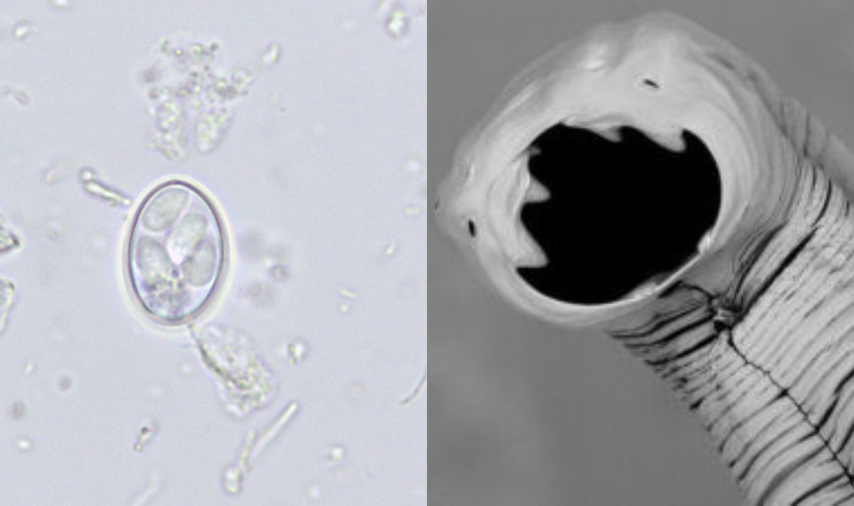 Sarcocystis parazitų oocista, aptikta gamtinių vandens mėginių mikroskopavimo metu Gamtos tyrimų centro Genetikos laboratorijoje. Parazitinė kirmėlė (helmintas).