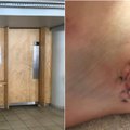 Traumą patyrusi mergina: durys trenkė taip, kad kraujas bėgo čiurkšle