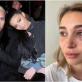 Kylie Jenner „eks“ vaikinas Tyga suimtas dėl šiurpaus nusikaltimo: mergina paviešino sumušimų žymes, kruvinus drabužius