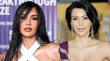 Plastikos chirurgas įsitikinęs – naujausia operacija gerokai pakeitė Kim Kardashian veidą: po šios procedūros skauda net kramtant